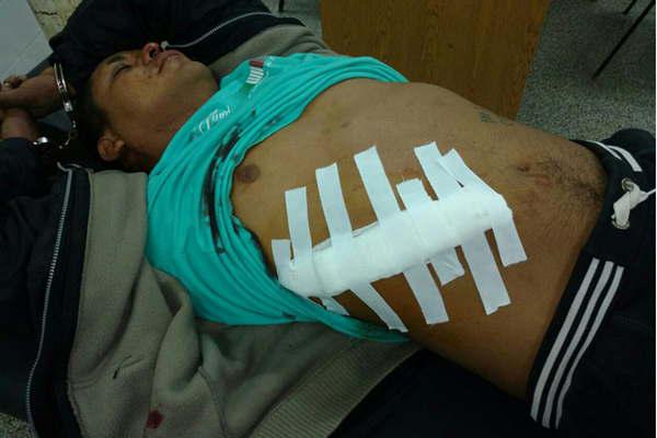 Postergan para mantildeana la indagatoria a Monito Castantildeo