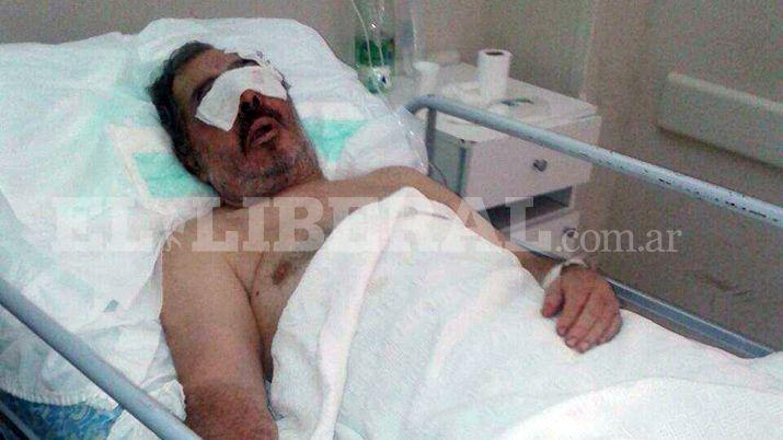 Gracias a Dios estaacute vivo despueacutes de recibir semejante tortura