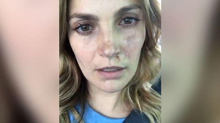 Una actriz usoacute su Instagram para contar coacutemo sobrevivioacute al sismo