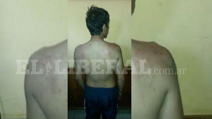 Detuvieron al Negro despueacutes de arrebatar una cartera en inmediaciones del Cepsi