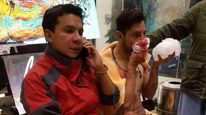 Hinchas de Wilstermann fueron atacados por barrabravas de River