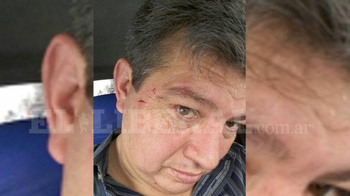 Patotearon y le cortaron la cara a candidato a diputado de Mirolo