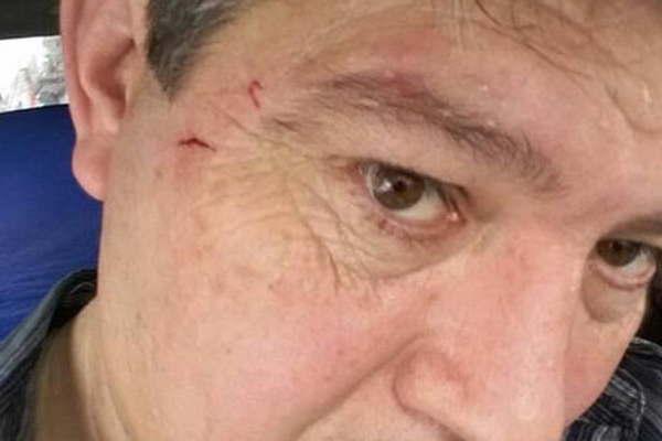 Candidato a diputado y sindicalista se enfrentaron a golpes de puntildeo y patadas en plena calle ceacutentrica