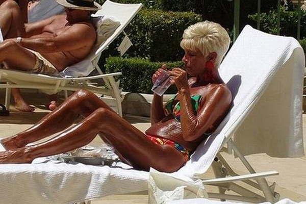 Tanorexia cuando estar bronceado se transforma en una enfermedad