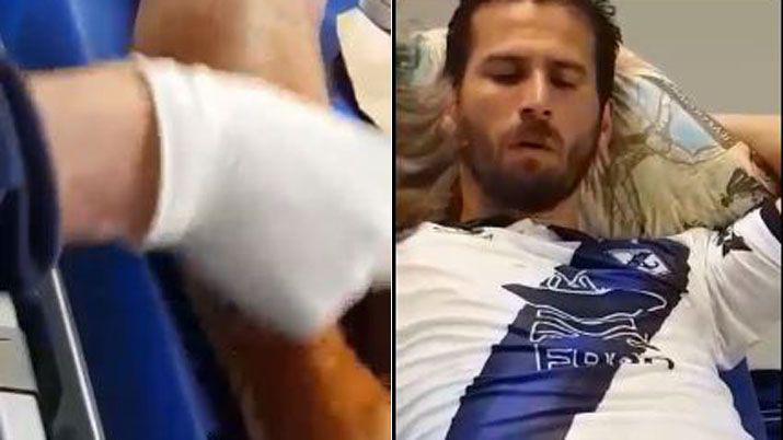 Escalofriante lesioacuten de un jugador de la B Nacional