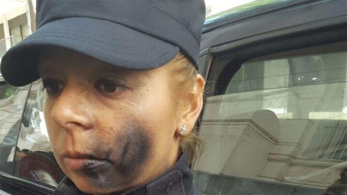 Le pintaron la cara a una mujer policiacutea que custodiaba la morgue
