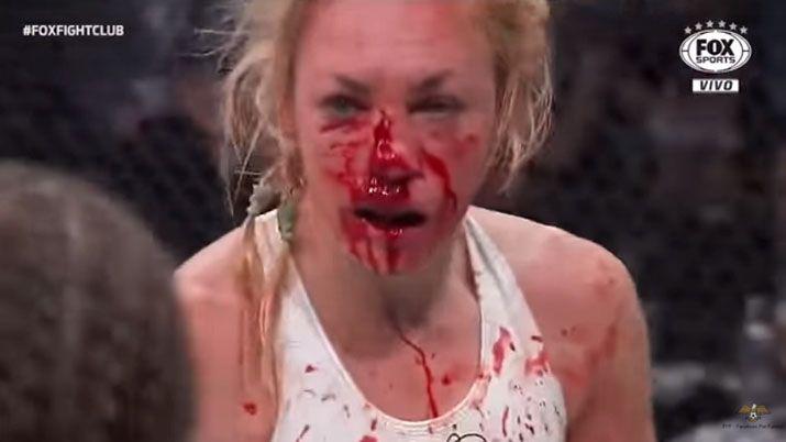 Le desfiguraron la cara en una lucha de MMA