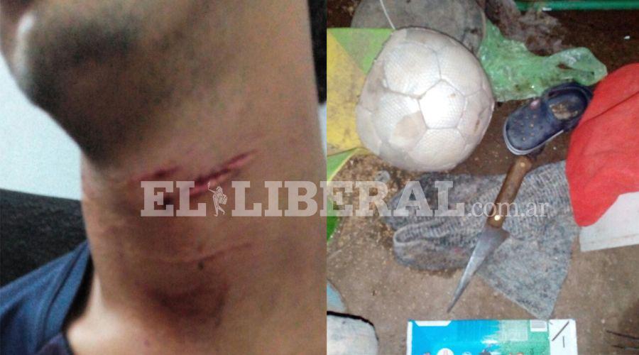 Acuchilloacute a su vecino y luego se realizoacute cortes en el cuello