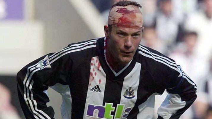 Alan Shearer tiene secuelas por meter tantos goles de cabeza