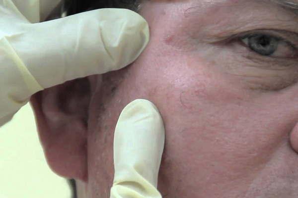 Existen diferentes tipos de caacutencer de piel y cada uno de ellos presenta caracteriacutesticas claramente detectables