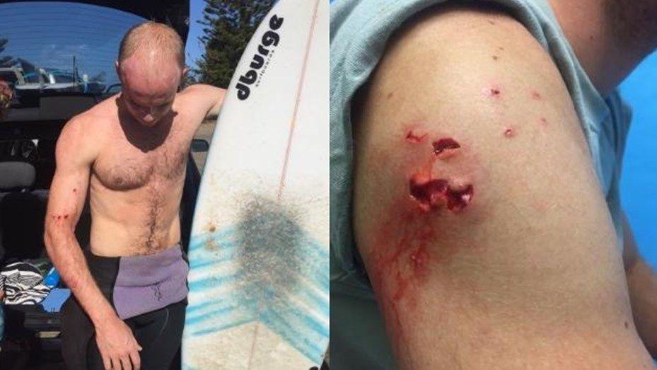 Un video de YouTube le salvoacute de un ataque de un tiburoacuten