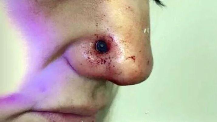 Disfrutaba de un helado en la plaza y una bala impactoacute en su nariz