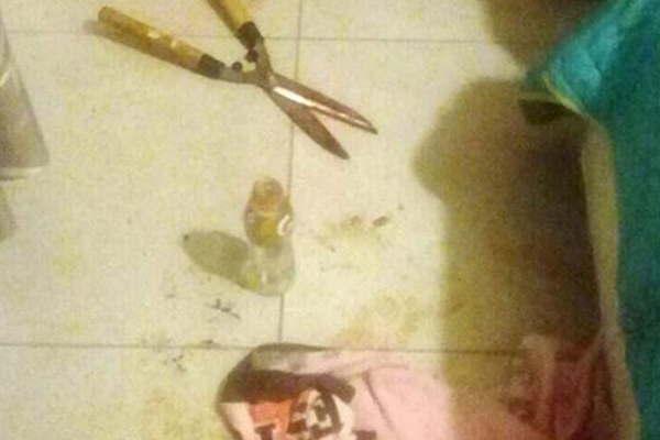 Arquitecta le cortoacute el pene y testiacuteculos a su novio con una tijera de podar