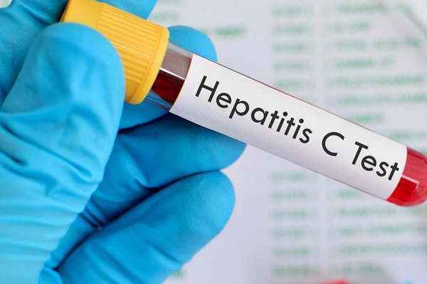 Aconsejan a la poblacioacuten realizarse el test de hepatitis C