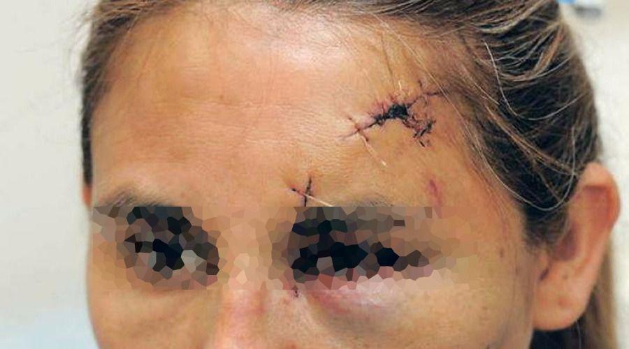 Le partioacute la cabeza con una sarteacuten y no lo denuncioacute por ser el sosteacuten de la casa