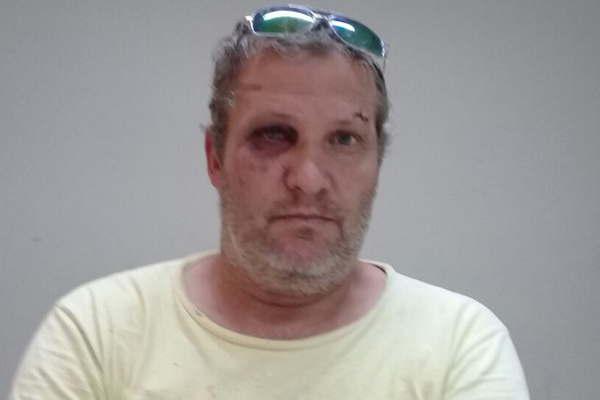 Termense denuncioacute que fue salvajemente agredido por  al menos seis tucumanos 