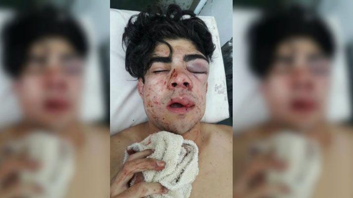 El joven tiene apenas 18 años