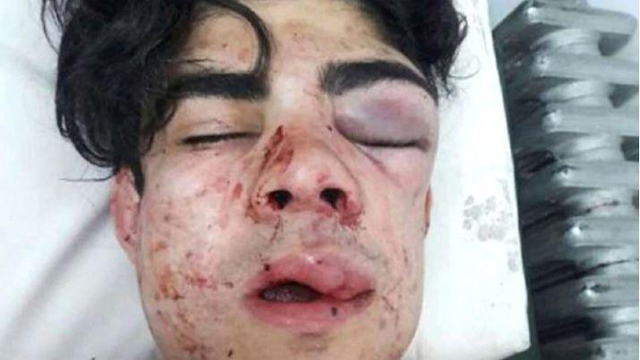 La víctima quedó desfigurada Foto- Los Andes