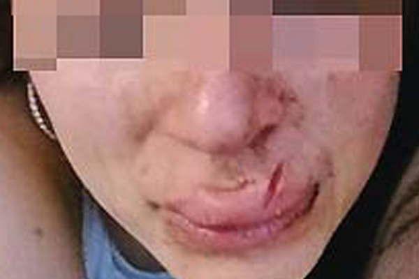 Ordenan detener al hijo del funcionario que desfiguroacute a su novia a golpes y mordiscones