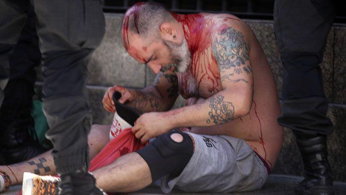 Los incidentes de esta jornada en imaacutegenes