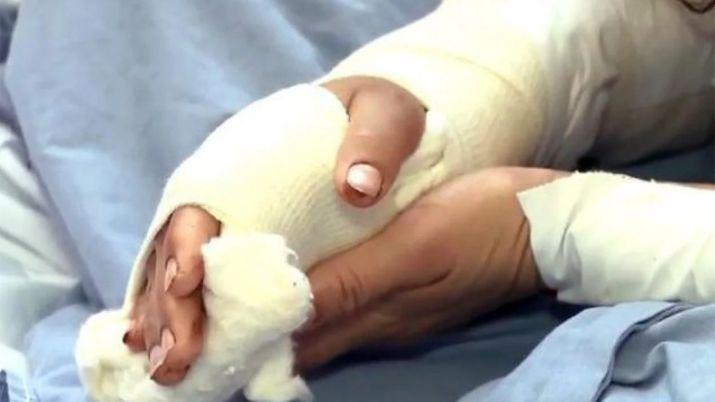Carnicero le cortoacute la mano con una trincheta a su mujer