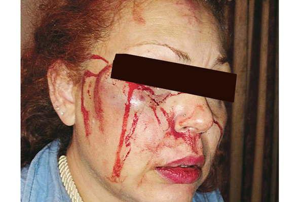 Extienden detencioacuten para sujeto que golpeoacute a su pareja en Antildeo Nuevo