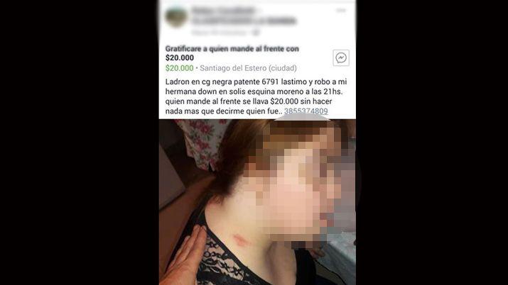 Buscan a un ladroacuten que lastimoacute a una joven con siacutendrome de down