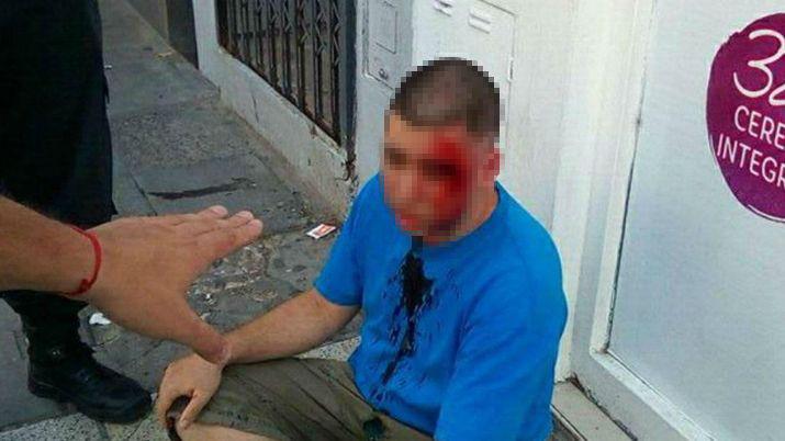 Citoacute al pedoacutefilo que acosaba a su hija y lo desfiguroacute a golpes