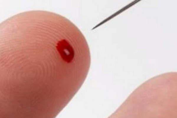 Prevencioacuten- coacutemo actuar ante un derrame cerebral