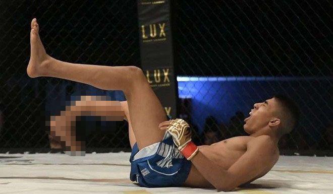 VIDEO  La horrenda lesioacuten que sufrioacute un peleador de MMA