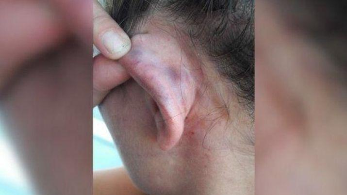 VIDEO  Una mujer filmoacute a su novio rugbier mientras la golpeaba