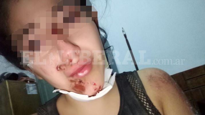 Una joven fue golpeada por su ex a la salida de un boliche