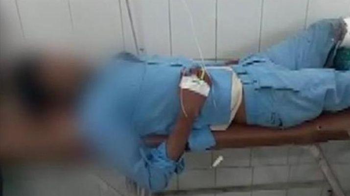 Meacutedicos suspendidos por usar una pierna amputada como almohada