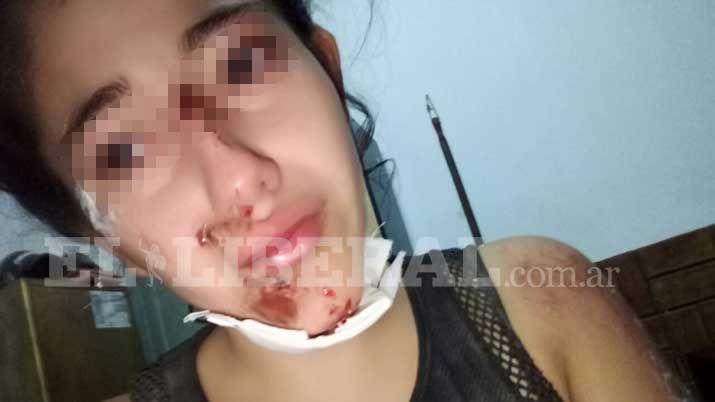 Detuvieron al joven que dio feroz paliza a su novia en Loreto