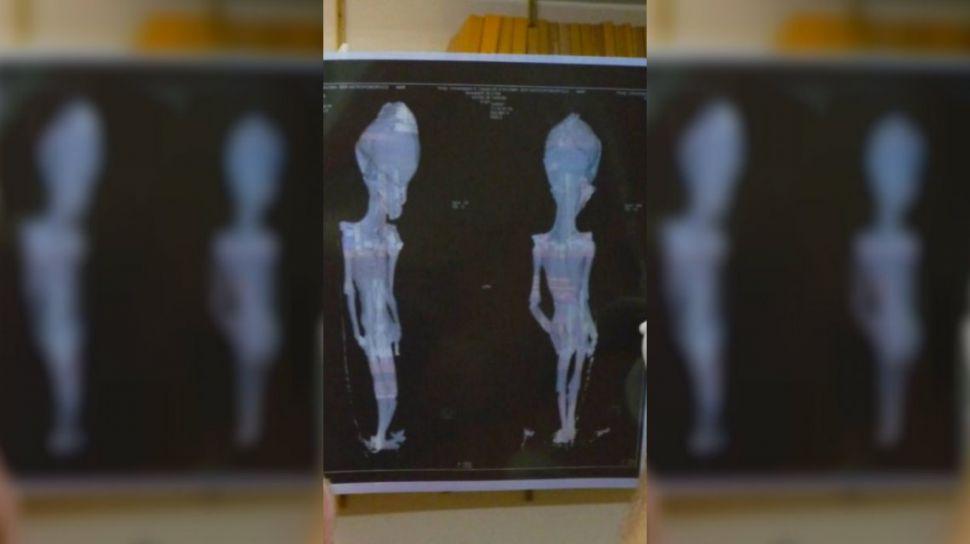Chile- resolvieron el misterio de la momia alien de Atacama tras 15 antildeos