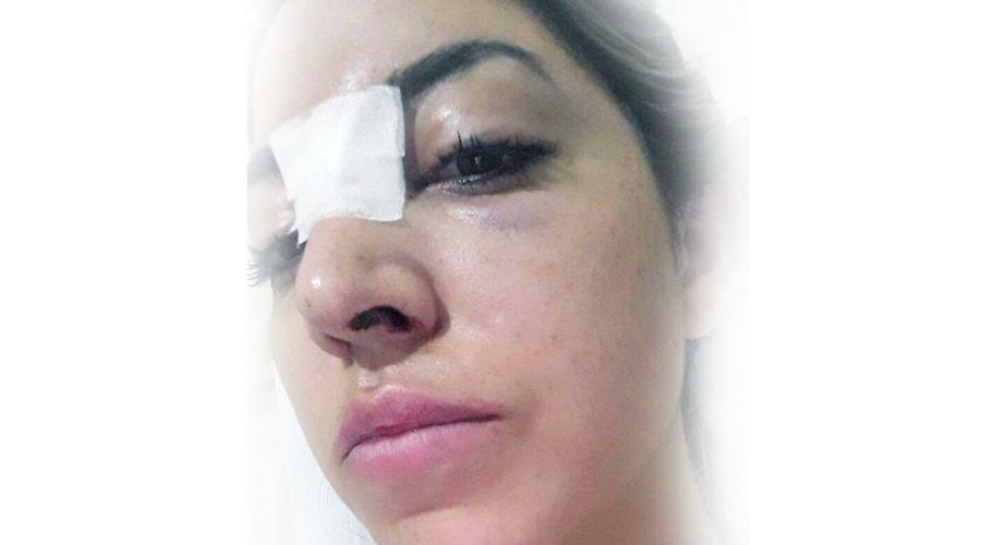 Hace dos antildeos en Mar  del Plata me amenazoacute y ahora cumplioacute es agresiva