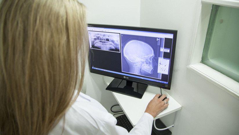 Le incrustaron una llave en la cabeza y sobrevivioacute para contarlo