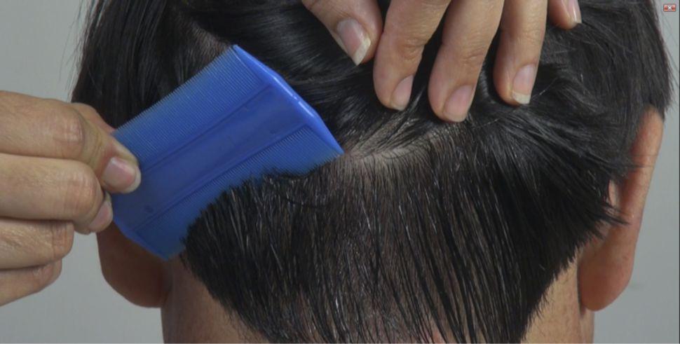 Insoacutelito- una maestra les dio a sus alumnos la tarea de traer dos piojos vivos