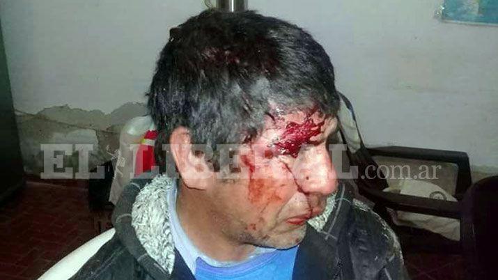 Policiacutea fue denunciado por agredir a un hombre con retraso madurativo