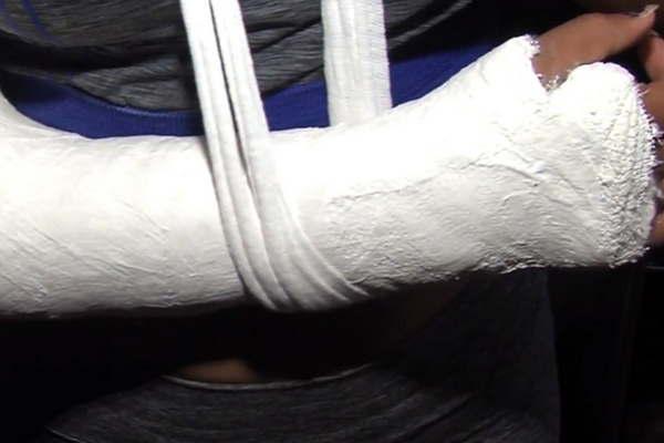Balut fracturoacute a patadas a una adolescente de 14 antildeos