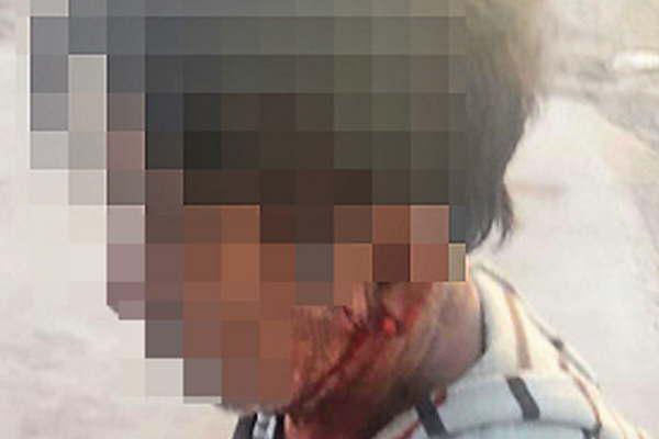 Dos amigos bebieron uno se durmioacute el otro lo comenzoacute a violar y tras despertarse se trenzaron en un sangriento duelo a cuchillo