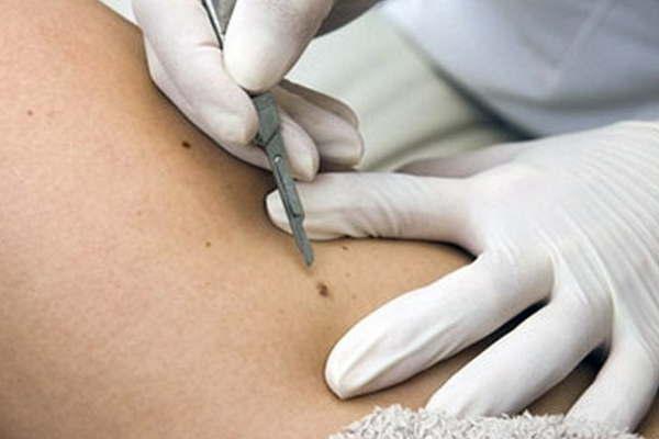 iquestExisten tratamientos meacutedicos para combatir esta afeccioacuten de la piel