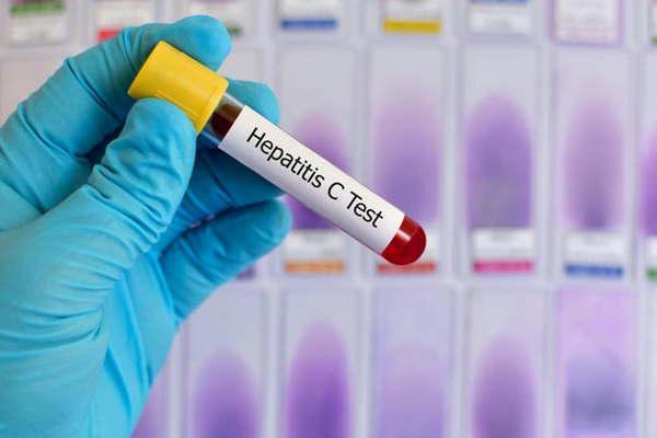 Realizaraacuten pruebas gratuitas para detectar hepatitis C