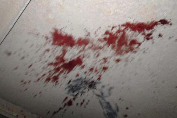 Camionero atropelloacute a un ciclista le provocoacute la muerte en el acto y se fugoacute de la escena del hecho
