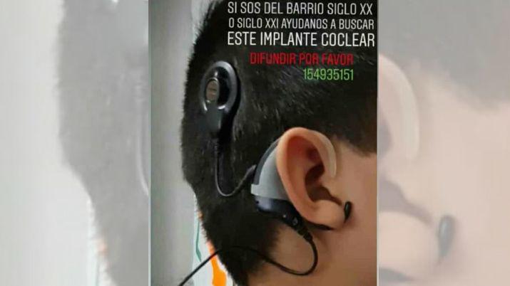 Le robaron el implante coclear y su familia solicita ayuda