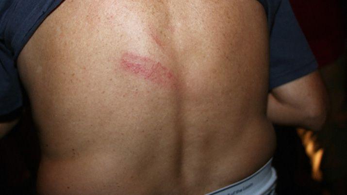 El hombre radicó la denuncia