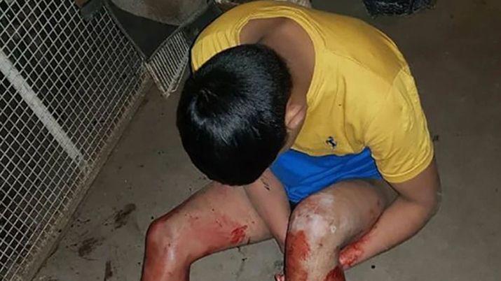 Escalofriante- entroacute a robar y fue sorprendido por un Pitbull