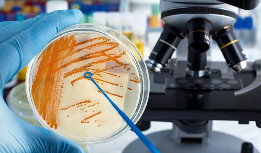 Estreptococo- cuaacutel es el origen de la bacteria