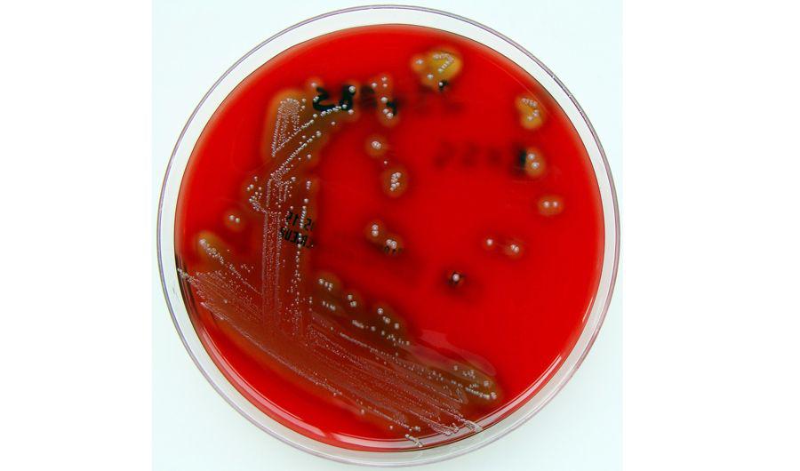 Cuaacuteles son los siacutentomas para consultar al meacutedico