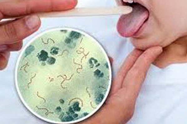 Meacutedicos piden no alarmarse y  prestar atencioacuten a los siacutentomas